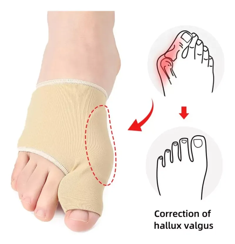 Comprar Par X2 Unidades Corrector De Juanete en Electroshopy - Ángulo 3